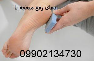 دعای رفع میخچه پا